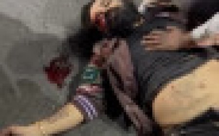 Jabalpur News: बिलहरी मेन रोड में देर रात हुआ हादसा,युवक के पैर पर चढ़ा भारी वाहन, हालत गंभीर