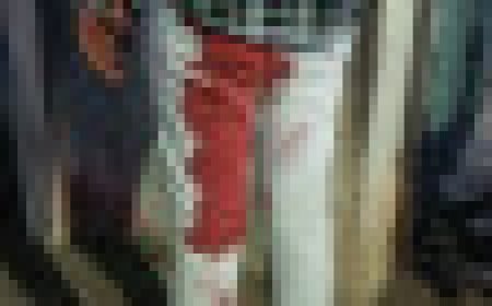 Jabalpur News: डायल-100 वाले भी सुरक्षित नहीं, अब चालक को आदतन बदमाश ने मुखबरी के शक में मारी चाकू