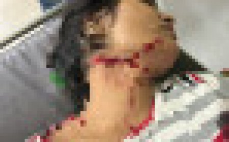 Jabalpur News: लव अफेयर के शक में महिलाओं के बीच चले चाकू, एक की मौत 1 गंभीर