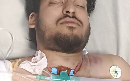 Jabalpur News: रांझी क्षेत्र के बापू नगर के युवक पर जयपुर में हुई फायरिंग, गंभीर... अन्य तीन बाल-बाल बचे