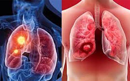 ऑफिस में बैठे-बैठे भी हो सकते हैं फेफड़ों की बीमारियों के शिकार, जान लीजिए इसकी वजह