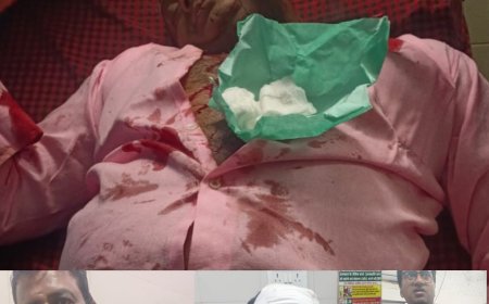 Jabalpur News: सदर बाबादीन चौक में चाकूबाजी, कांग्रेस नेता सहित चार घायल