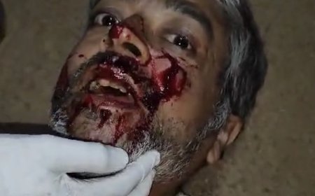 Jabalpur News: तेंदुए के हमले में बाल-बाल बचा जबलपुर का महाजन परिवार