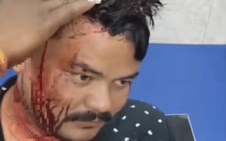 Jabalpur News: ट्रक ने युवक को रौंदा, आक्रोशित ग्रामीणों ने फूंक दिया ट्रक, फायर ब्रिगेड कर्मियों पर चलाएं पत्थर