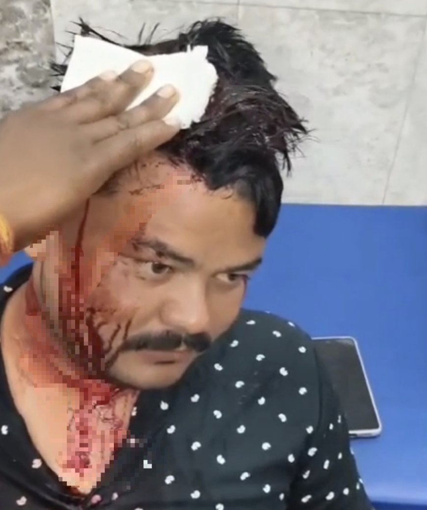 Jabalpur News: ट्रक ने युवक को रौंदा, आक्रोशित ग्रामीणों ने फूंक दिया ट्रक, फायर ब्रिगेड कर्मियों पर चलाएं पत्थर