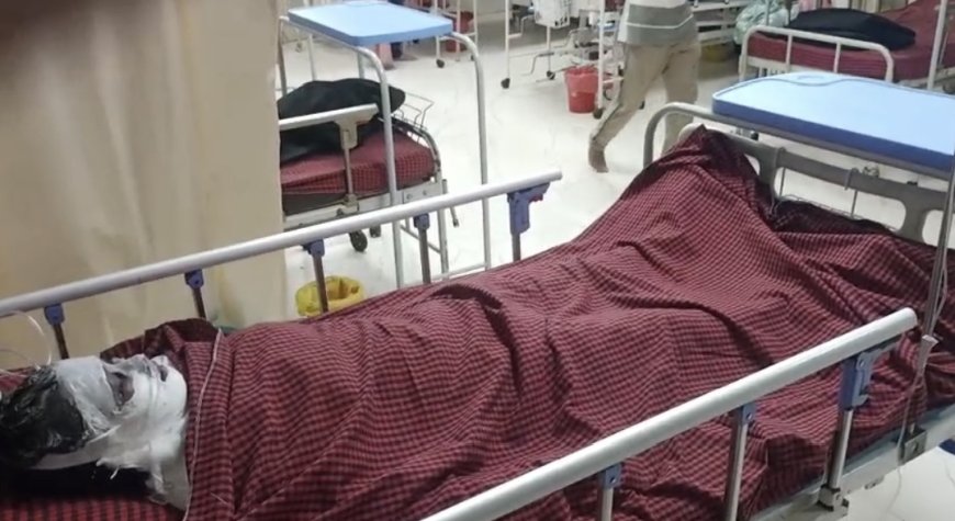 Jabalpur News: इंजीनियरिंग की छात्रा ने अपनी सहेली पर उड़ेला तेजाब, अवधपुरी कालोनी की घटना