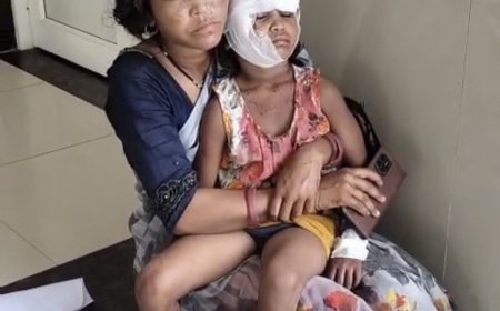 Jabalpur News: कुत्तों के झुंड ने 6 साल की मासूम पर किया हमला, बुरी तरह नोंचा