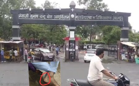 Jabalpur News: कलेक्टर की सख्ती का असर, एचएलएल इंफ्रा टेक पर 50 हजार का जुर्माना, मरीजों के पैरों को चूहों द्वारा कुतरने का मामला