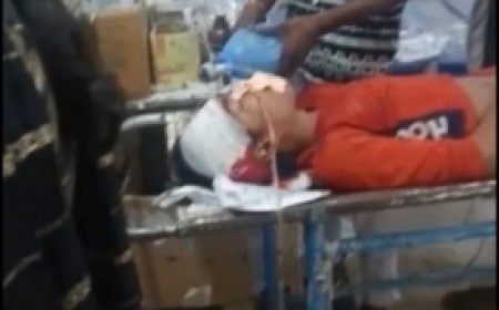 Jabalpur News: बिलहरी में दुर्गा पंडाल तैयार कर रहे टेंट कर्मी को तेज रफ्तार कार ने मारी टक्कर, 2 गंभीर