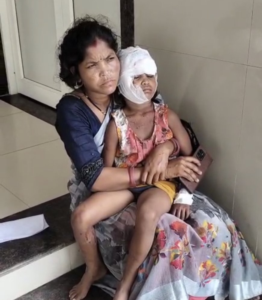 Jabalpur News: कुत्तों के झुंड ने 6 साल की मासूम पर किया हमला, बुरी तरह नोंचा