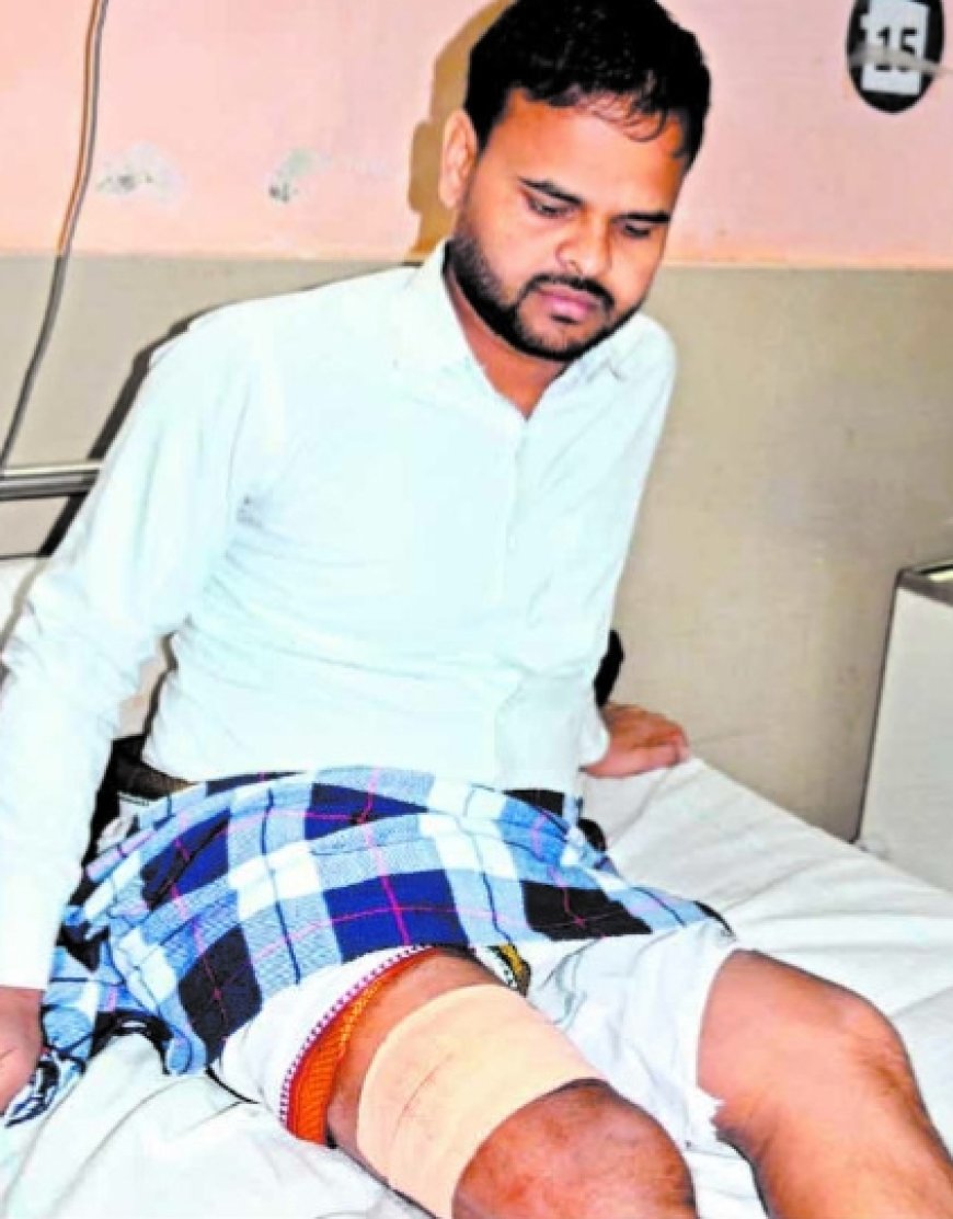 Jabalpur Breaking News: नकाबपोश लुटेरों ने बिलहरी निवासी टीटीई पर किया हमला, रात 2 बजे सर्किट हाउस के समीप सनसनीखेज वारदात