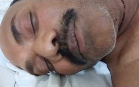 Jabalpur News: युवक की आंख में मिर्ची झोंक, मार दी गोली