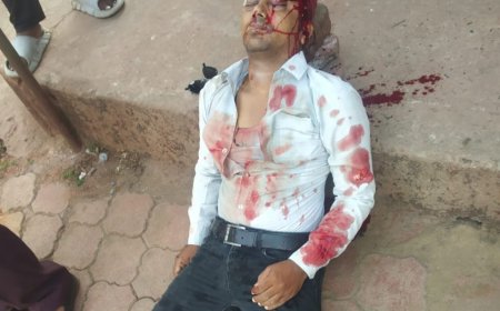 Jabalpur News: मोटरसाइकिल सवार बदमाशों ने सिविल कांट्रेक्टर को बीच चौराहे मारी गोली