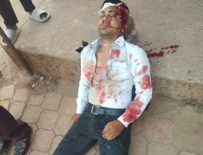 Jabalpur News: मोटरसाइकिल सवार बदमाशों ने सिविल कांट्रेक्टर को बीच चौराहे मारी गोली