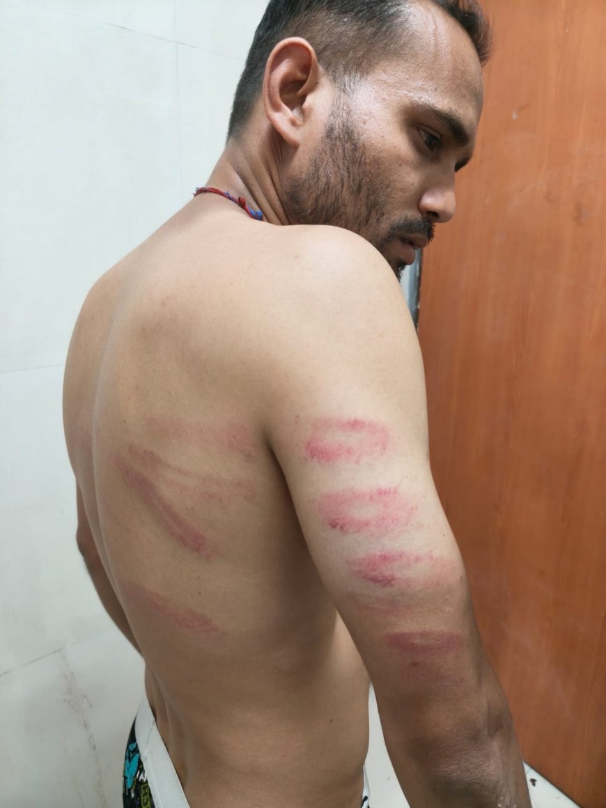 Jabalpur News: अमरनाथ यात्रा के रजिस्ट्रेशन में विवाद, युवक की पिटाई, पुलिस जवानों पर आरोप... वीडियो वायरल