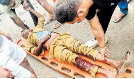 Jabalpur News: गेस प्लांट के पास सड़क हादसा, दो घायल